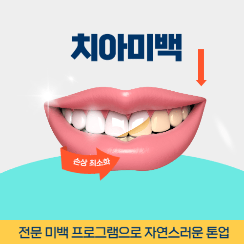 거제치과 거제시 치과 치아미백